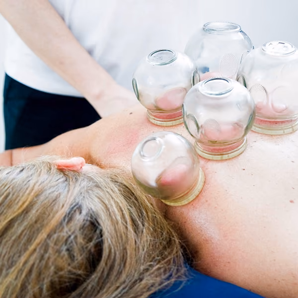 Dr. Rachel Abare OMD: Cupping Therapy Near Reno, NV